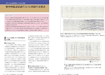 958 新分類・新薬でわかる 小児けいれん・てんかん診療 新分類・新薬でわかる 小児けいれん・てんかん診療 (小児科ベスト
